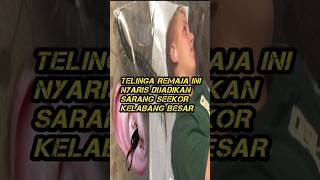 Kelabang besar nyaris membuat sarang di dalam telinga remaja ini | Grant Botti