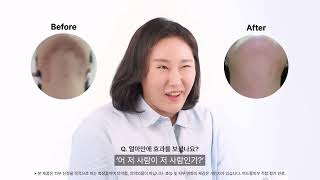 [퍼셀] 이런게 진짜 비포앤애프터(before and after)입니다.