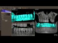 Waxup QuickVision 3D OWANDY RADIOLOGY (slow version)