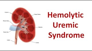 Hemolytic Uremic Syndrome