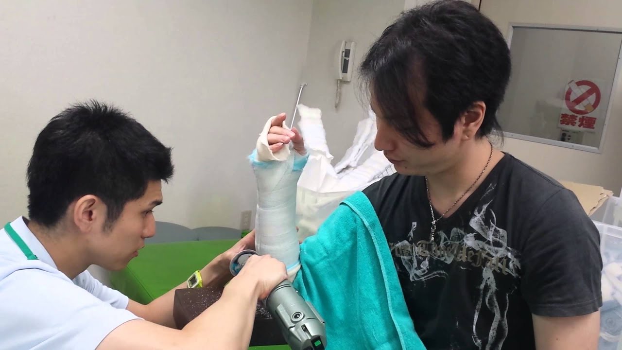 実技:手関節のギプス固定 ギプスカット The removed cast for fore arm to wrist, which is the japanase JuDo thetapy 実技:手関節のギプス固定 ギプスカット The removed cast for fore arm to wrist, which is the japanase JuDo thetapy