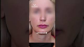 Так ли хорош липофилинг?