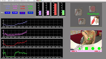 Augmented Reality Based Reaching Exercise for shoulder Rehabilitation