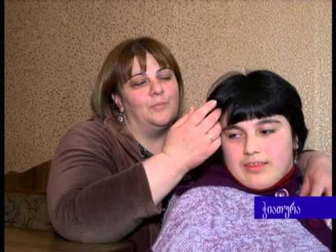 ჭიათურაში შშმ პირთა დღესთან დაკავშირებით ღონისძიებები  გაიმართა