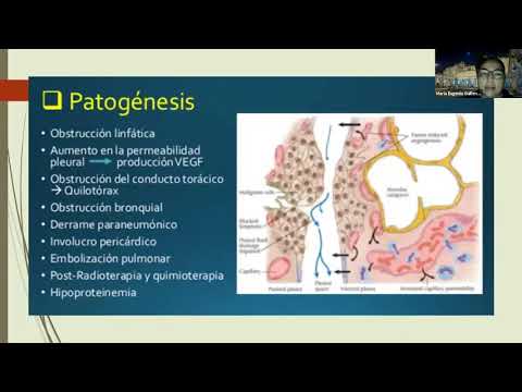 Video: ¿Qué significa pleurodesis?