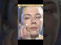 Hamari Skin Par Pimples Kyun Nikalte hain.🤔#education #viral #shorts
