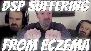 DSP CREAMS HIS HANDS BECAUSE HE SUFFERS FROM ECZEMA??