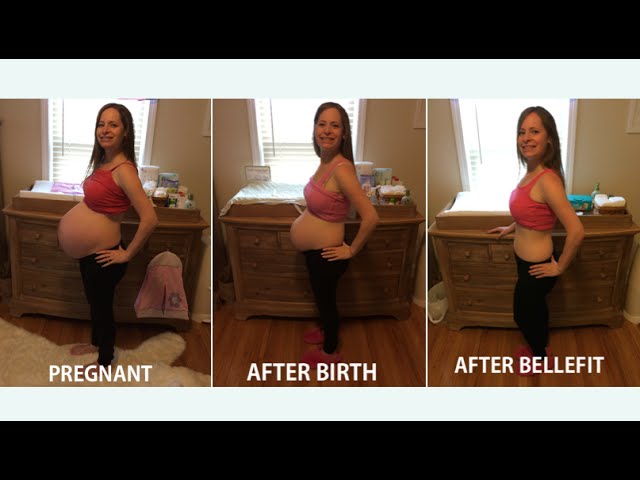 Bellefit Girdle Dual-Closure Before and After Results 