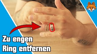 Zu engen Ring vom Finger entfernen - Fadentrick 💎 - YouTube