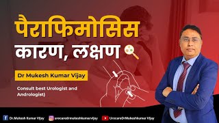 What Is Paraphimosis? What Is Its Treatment? Dr. Mukesh Kumar Vijay