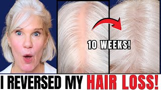 Reversed SCARY, SUDDEN Hair Loss (Hair Loss Solutions Over 50!) by Beyond50Skin 3,591 views 1 month ago 12 minutes, 23 seconds