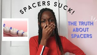 SPACERS SUCK! the truth about spacers (for braces)
