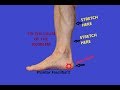 Plantar Fasciitis Treatment - Calf Stretches