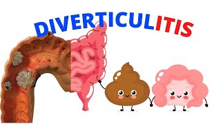 What Is Diverticulitis? A Brief Overview, Causes And Treatment.