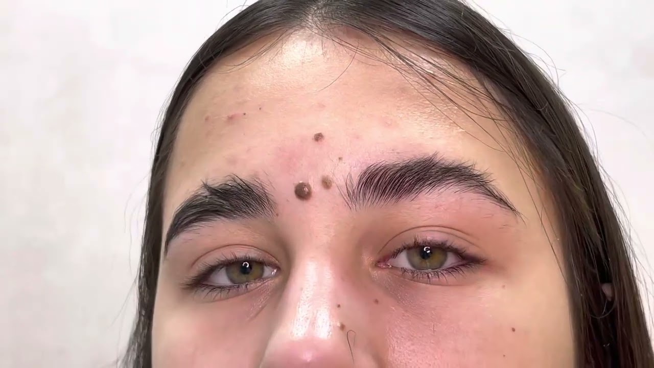 RARIREA SPRÂNCENELOR / NU TUNDEREA SPRÂNCENELOR