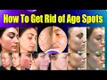 How To Get Rid of Age Spots! Remove Age spots On Face:HowToTreat Age Spots-Age Spots Removal On Face
