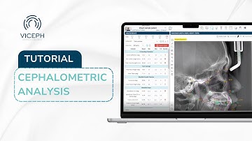 HOW TO USE VICEPH | AI-POWERED CEPHALOMETRIC ANALYSIS