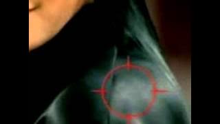 Iklan Clear - Ketombe, Siapa Takut!? (2001) @ RCTI