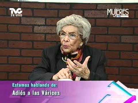 Que hacer si son enconadas las venas en los pies