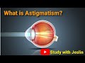 Astigmatism in Tamil | What is Astigmatism | Study with Jeslin |