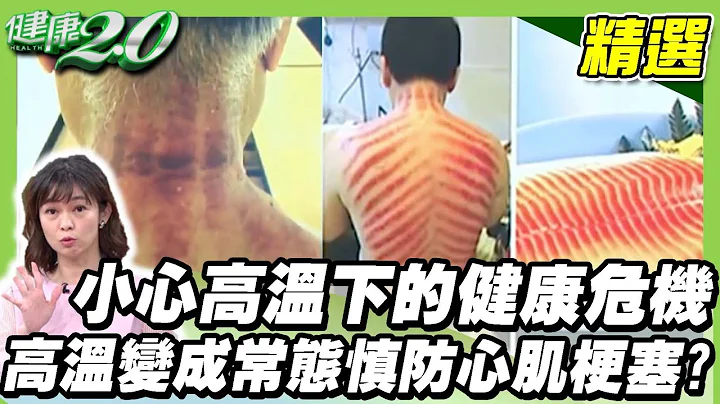 高溫變成常態 夏天慎防心肌梗塞？ 小心高溫下的健康危機！ 炎夏養生術 【健康2.0精選】 - 天天要聞