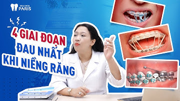 4 giai đoạn đau nhất khi niềng răng