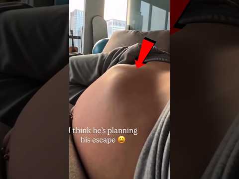 چرا شکمش اینطوره