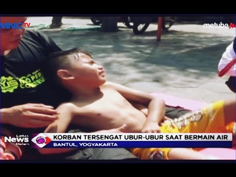 Video: Haruskah Anda pergi ke rumah sakit karena sengatan ubur-ubur?