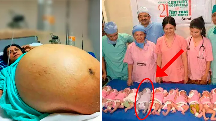 Mother Gives Birth to 10 Babies and Doctors Realize One of Them Isn't a Baby! Biggest Shock! - DayDayNews
