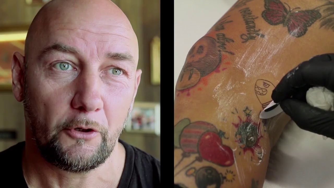 Tattoo entzündet und eitert