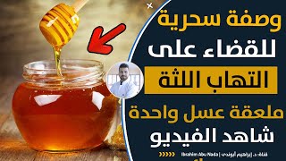 طرق طبيعية للقضاء على التهاب اللثة في المنزل | ملعقة واحدة من العسل لن تصدق ما ستفعله بجسمك وأسنانك