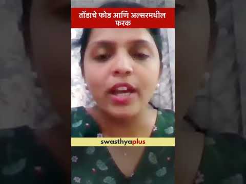 तोंडाचे फोड आणि अल्सरमधील फरक | Difference between Mouth Sores & Ulcers | Dr Mrunal Godse | #Shorts