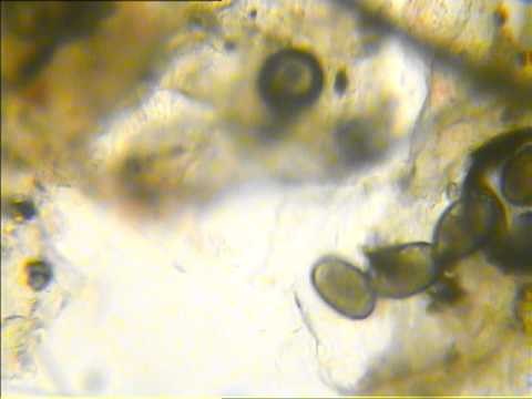cheyletiella mites from Guinea pig - YouTube