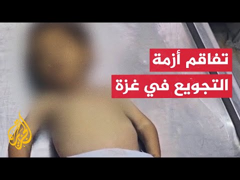 بينهم طفلة.. استشهاد 10 فلسطينيين جراء التجويع في غزة