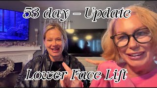My Sister (Traci) shares update on her S-Lift Procedure.