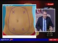 شفط الدهون وتنسيق القوام مع استشاري التجميل دكتور احمد فرجاني 