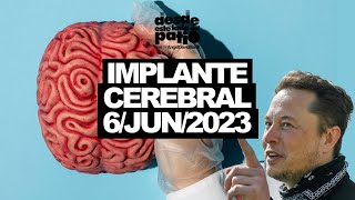 Musk Comienza A Ensayar Con Implantes Cerebrales | El Show De Angel David Sardi