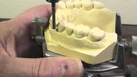 R P D Design - Ken Class IV Max Cast #2 Dot Part B