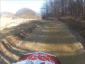 MOTOCROSS CRASH Broken Bones