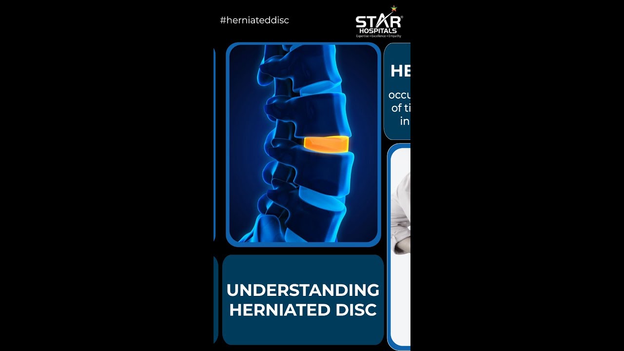 Understanding Herniated disc YouTube