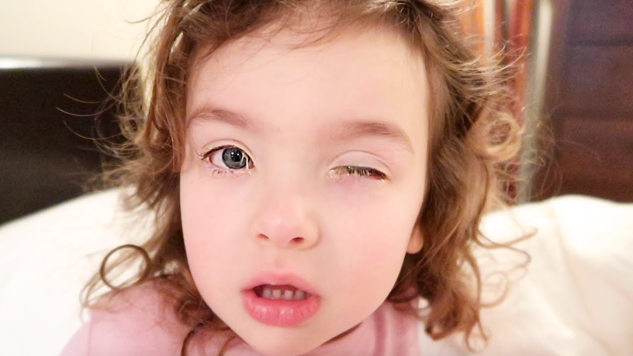 SHE WOKE UP WITH HER EYES GLUED SHUT! YouTube