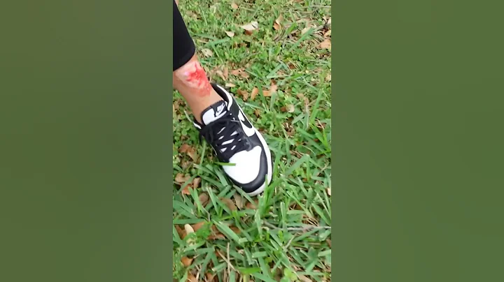 something bit her #shorts