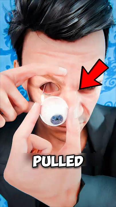 You Could Pull Out Your Eye and Still See!!😲😱