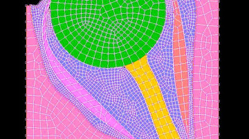 FEM Cocontraction remesh