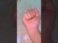 اذا تنثر ملح ايدك على الجرح تذبحي اموت