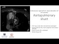Endovascular approach for revascularization of an occluded aortopulmonary shunt