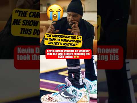 KD on the viral pic of his ashy legs 😭😭