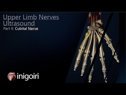 Видео: Увличане на Ulnar Nerve: симптоми, причини упражнения и хирургия