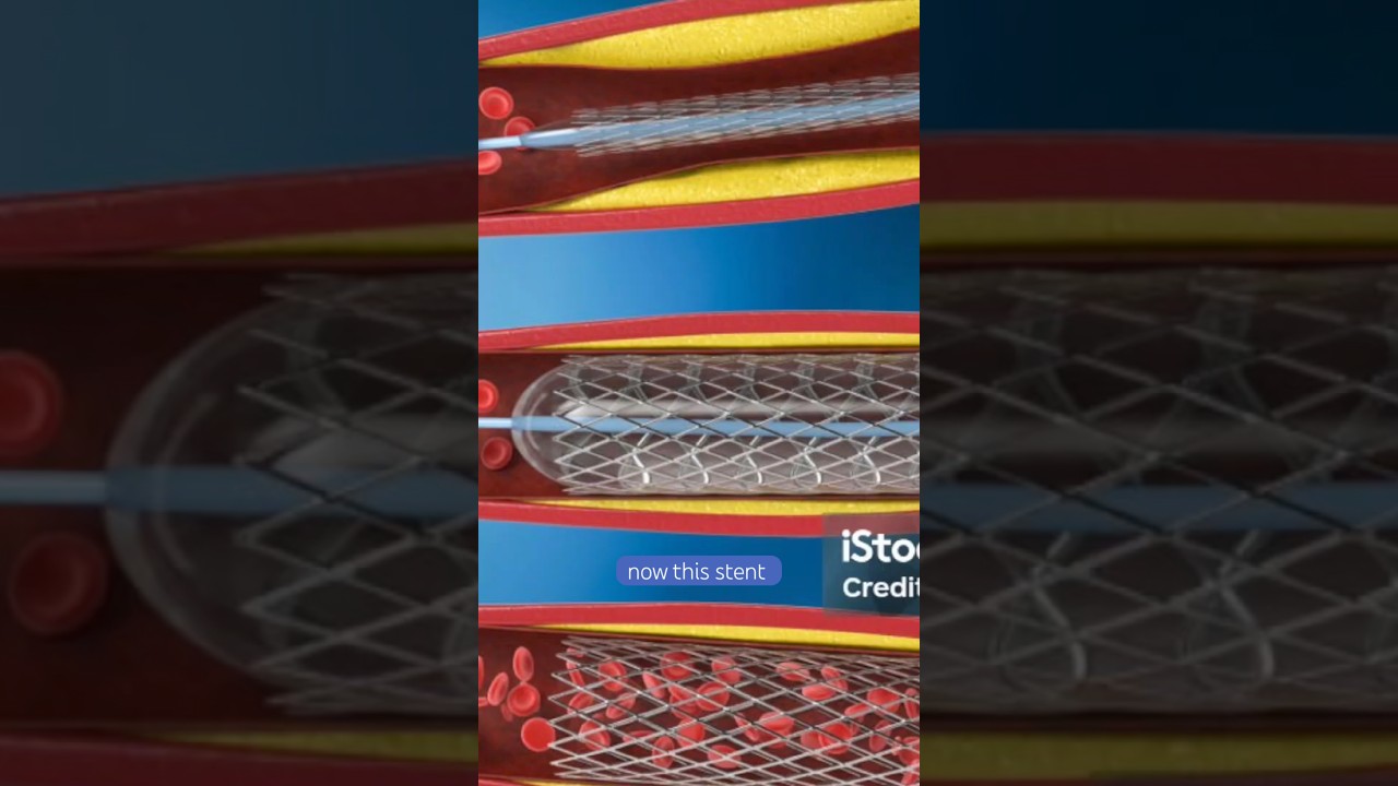 Medication adherence is crucial for survival 