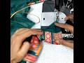 कंधा जोडने का सही तरीका🥺|sewing tips and tricks|#trending #shortsfeed #viral